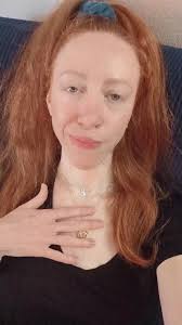 gingervitis (@ginger.muse)