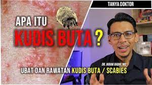 Sebab itu ubat yag biasa diberi oleh doktor dalam merawat masalah kudis buta adalah ubat pembunuh hama yang perlu disapu pada kulit. Apa Itu Kudis Buta Scabies Ubat Dan Cara Merawat Kudis Buta Youtube