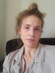 Mother-of-two, 40, who spent thousands of pounds a year getting Botox and  fillers reveals the lifestyle change that 'finally made her look young'