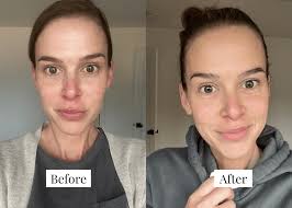 Solawave Wand Review: Does It Really Work?!