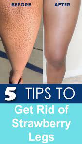 Strawberry Legs 5 Tips To Get Rid Of Strawberry Legs Getinfopedia Strawberry Legs Diy Beauty Treatments Clear Skin Tips