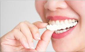 What smile problems does it address? Magic Teeth Brace Perfect Smile Veneers