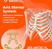 Jeil Medical Brasil | Projetado para estabilizar fraturas da ...
