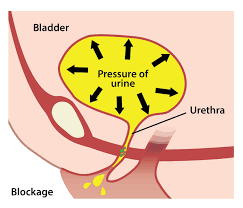 Ginjal ( ren ) kanan dan kiri ureter kanan dan kiri vesika urinaria ( blaast ) uretra struktur… 6 Penyakit Sistem Urine Ini Bisa Fatal Jangan Dibiarkan