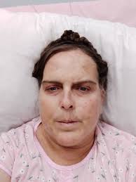 Dealing with severe muscle cramps and pain?