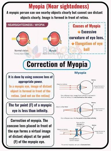 Pathological Myopia - Retinal and Macular Complications