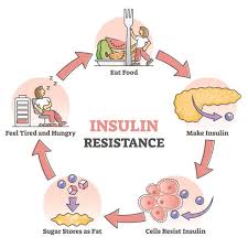Weight loss can help the body respond better to insulin. Ue6po6npk4mtlm