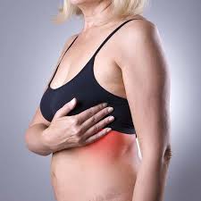 Image result for heat rash under breasts