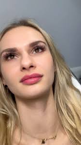 𝘕𝘢𝘵𝘶𝘳𝘢𝘭 𝘓𝘪𝘱 𝘙𝘦𝘴𝘶𝘭𝘵𝘴 ✨ , This client had 1ml over two  separate appointments for definition and a touch more volume. , Contact us  for your free consultation today., 𝖨𝖬𝖬𝖠𝖢𝖴𝖫𝖠𝖳𝖤 𝖳𝖮𝖴𝖢𝖧  𝖠𝖤𝖲𝖳𝖧𝖤𝖳𝖨𝖢𝖲⁠ 💉𝘗𝘔𝘜 & ...