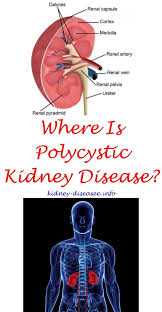 Kidney Location Kidney Disease Kidney Disease Recipes Polycystic Kidney Disease