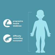 Muscular Dystrophy Signs Symptoms And Complications