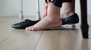 Can You Wear Compression Stockings 24 Hours A Day