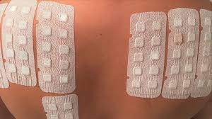 Image result for Patch Testing