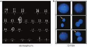 Maybe you would like to learn more about one of these? A T 8 14 Q24 Q11 In A Patient With T All B Ci Fish Results The Download Scientific Diagram