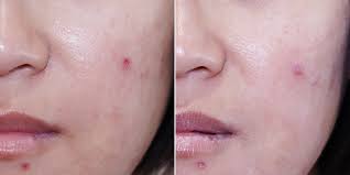 Secret Key Snow White Cream Review – THE YESSTYLIST - Asian ...