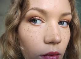 Image result for Freckles