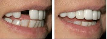 We will provide excellent customer service in a caring and awesome dentist, i have had so many bad experiences with dentists it was refreshing to find someone who cares. 5 Steps To Designing The Perfect Smile The Perfect Smile Studios