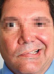 We did not find results for: Zika Virus And Guillain Barre Syndrome Springerlink