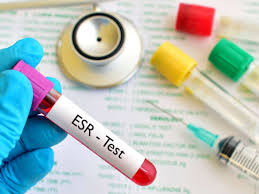 Rheumatoid Arthritis And Crp Levels What Is Normal