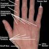 Wrist tendons are divided into the flexor and extensor subgroups, and are best appreciated in the axial plane (figure 14). 1