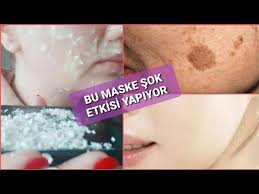 Aninda Etki Ile Sok Oldum Bembeyaz Bir Cilt Icin Leke Gideren Kolajen Destegi Maske Lekegidereci Youtube Kolajen Cilt Urunleri Cilt Bakimi