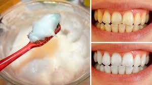 Come Sbiancare I Denti A Casa Tua In Modo Naturale E In Soli 3 Minuti Nel 2020 Sbiancare I Denti Sbiancamento Naturale Dei Denti Cibo Vegano