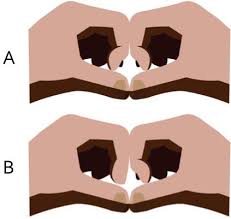 Image result for Elson Extensor Tendon Test