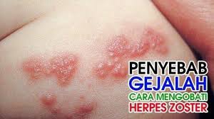 Pin Di Kesehatan