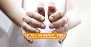 4 Types Of Ms Related Tremors Multiple Sclerosis News Today
