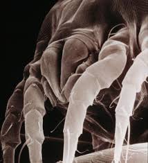 Image result for Dust mite