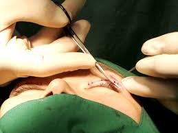 Check spelling or type a new query. The Most Popular Plastic Surgery In Korea