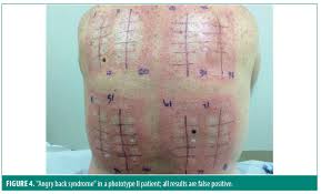 Image result for Patch Testing