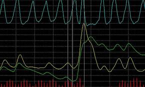 is a polygraph a reliable lie detector