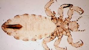 Image result for Lice