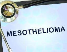 Check spelling or type a new query. Who Is Eligible To File A Mesothelioma Wrongful Death Lawsuit Law Track