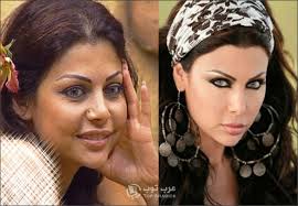 لا تخلو أي عملية تجميل من عيوب تحتاج في حد ذاتها إلى إجراء عمليات أخرى لتصحيحها. ØµÙˆØ±Ø© Ù‡ÙŠÙØ§Ø¡ ÙˆÙ‡Ø¨ÙŠ Ù‚Ø¨Ù„ Ø¹Ù…Ù„ÙŠØ© Ø§Ù„ØªØ¬Ù…ÙŠÙ„ ÙˆØ¨Ø¹Ø¯Ù‡Ø§ Ø§Ø¬Ù…Ù„ Ø¬Ø¯ÙŠØ¯