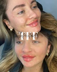 Thefacefairyaesthetics