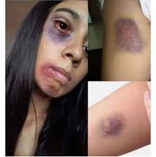 General Hospital Official Spoilers & News