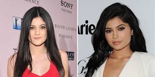 Updated at march 14, 2014 12:35 pm. Kylie Jenner S Plastic Surgeon Dr Simon Ourian Praises Kylie S Metamorphosis