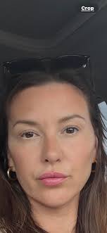 Lift for mid-lower face and neck?