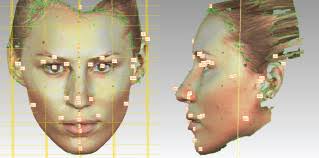 Identification of the Single Nucleotide Polymorphisms Affecting Normal  Phenotypic Variability in Human Craniofacial Morphology Using Candidate  Gene Approach