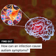 A new paper led by the university of virginia and just published in the journal behavioral and brain sciences is pushing back hard on. Is Autism Caused By Brain Inflammation Moleculera Labs