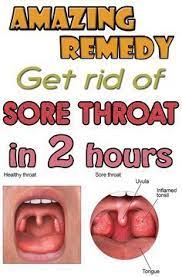 Amazing Remedy Get Rid Of Sore Throat In 2 Hours Strep Throat Remedies Throat Remedies Natural Health Remedies