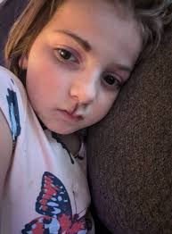 Why does my 2 year old look so sad?