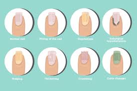 The nail may thicken over time, and it can crumble in severe cases. Psoriatic Arthritis Nail Changes Symptoms And Treatments