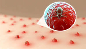 Image result for flea bite