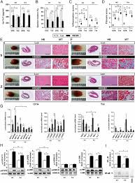 Airway inflammation • inflammation may be acute, subacute, or chronic, and the. Critical Role Of Rage And Hmgb1 In Inflammatory Heart Disease Pnas