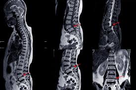 Image result for Low Back Imaging