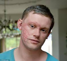 Road rage motorists jailed for a total of 25 years for spraying acid in  man's face