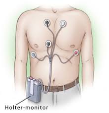 Image result for Holter Monitor